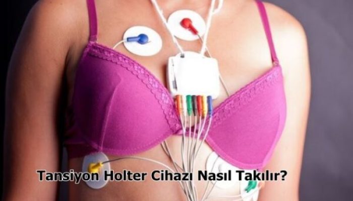 Tansiyon Holter Cihazı Nasıl Takılır?