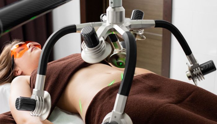 Liposuction Sonrası Cilt Sarkması: Tedavi Yöntemleri ve Önlemler